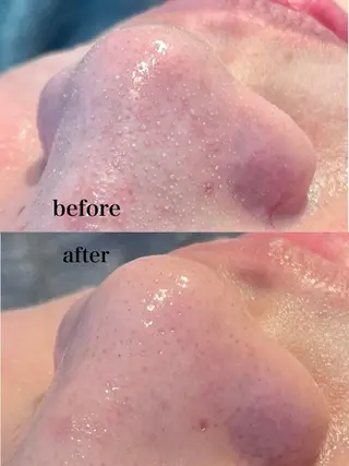 Beauty Salon AZUL所属・ビューティーサロン AZULのエステ・リラクイメージ