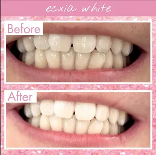 ホワイトニングサロンLuana-Sinfonia(エクシア)池袋店所属・セルフホワイトニング エクシア 池袋店のその他イメージ