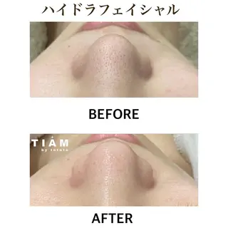 美肌サロンTIAM by tetoteのエステ・リラクイメージ