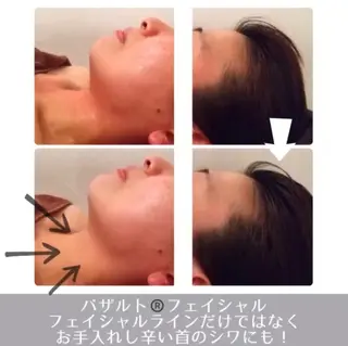 ラ・ルミエール所属・鈴木 えつこのエステ・リラクイメージ