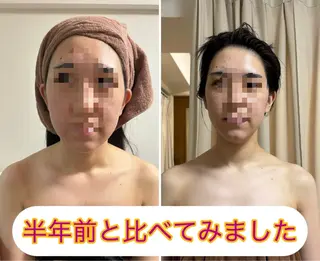 透明感の肌Lino malieのエステ・リラクイメージ