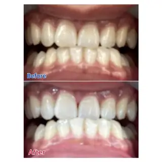 M渋谷店所属・Ｍ渋谷 ホワイトニングのその他イメージ