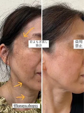 private salon  Dea_maris シュガーリング＆パーソナルボディケア所属・シミ改善・韓国肌管理 ボディメイク痩身のその他イメージ