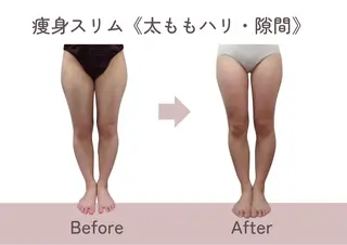 ビューティーサロン ティファニー横浜店のエステ・リラクイメージ