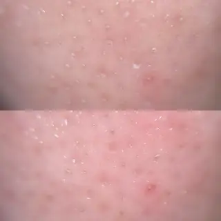 毛穴ケア/毛穴診断/ 毛穴洗浄〔心斎橋〕のエステ・リラクイメージ