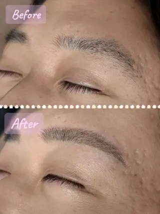 メンズ アイブロウ 六本木脱毛andS 🍀yuriのエステ・リラクイメージ