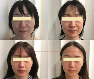 顔脱毛＆毛穴＆ニキビ 優良№1♪ヒロコ♪のエステ・リラクイメージ