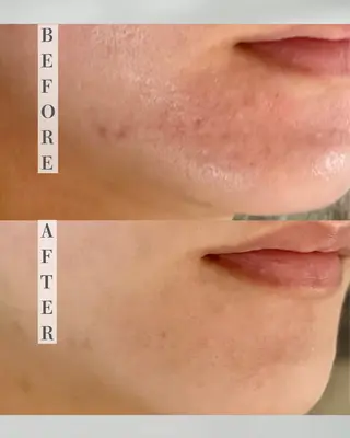 カムイ所属・カムイ 山﨑のエステ・リラクイメージ