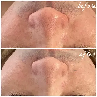 メンズ メナード岐阜茜部 杉浦のエステ・リラクイメージ