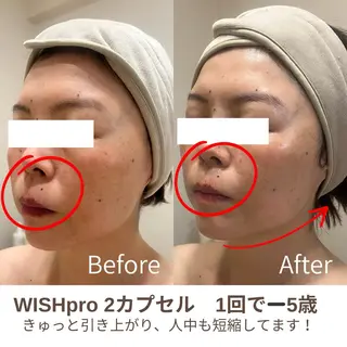 Total Beauty salon Bloom所属・肌育WISHpro 専門サロンBloomのエステ・リラクイメージ