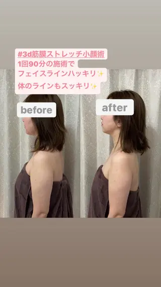 長堀橋エステサロン charmignonのエステ・リラクイメージ