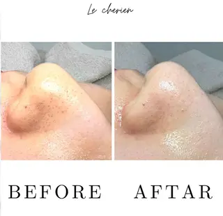 Le  cherien ル シェリア所属・毛穴洗浄/ハイフ サロンのエステ・リラクイメージ