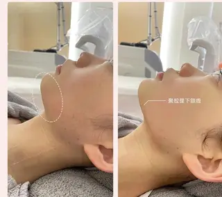 aliaハイフ&水光ジェットサロン所属・aliaハーブ水光店 エステティシャン募集のエステ・リラクイメージ