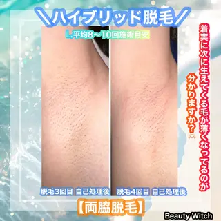 痩身/脱毛/ネイル HARUKAのエステ・リラクイメージ