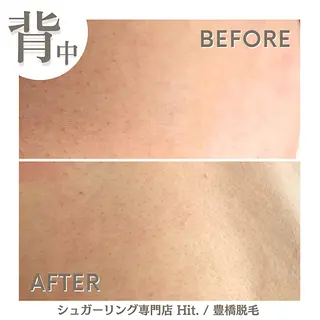 Hit. シュガーリング豊橋のエステ・リラクイメージ