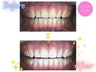 セルフホワイトニング エクシア新百合ヶ丘店のその他イメージ