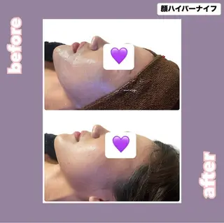 【痩身・脱毛サロン】 REBISKIN🌱のエステ・リラクイメージ