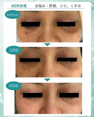 ResetLab 佐藤 風香のエステ・リラクイメージ