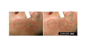 ヴィーナス ビューティーのエステ・リラクイメージ