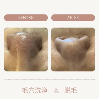 美肌脱毛と癒しのﾌﾟﾗｲﾍﾞｰﾄｻﾛﾝ。gratia~ｸﾞﾚｲﾃｨｱ~所属・gratia ~ｸﾞﾚｲﾃｨｱ~のエステ・リラクイメージ