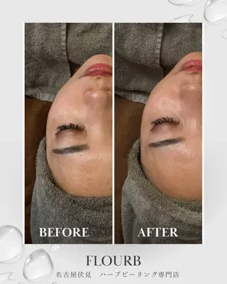 Flourb所属・ハーブピーリング専門 サロンFlourbのエステ・リラクイメージ