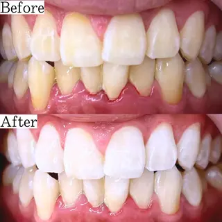 LBSホワイトニング 銀座店💎公式のその他イメージ