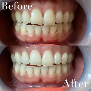 LBSホワイトニング 新宿店💝公式のその他イメージ