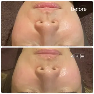 terhibur 〜テルヒブール〜のエステ・リラクイメージ