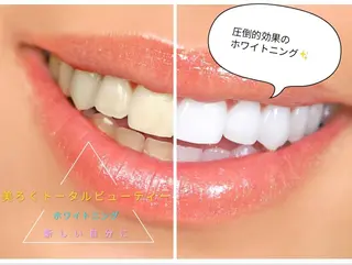 美ろく　トータルビューティーサロン所属・セルフホワイトニング メーカー直営サロンのエステ・リラクイメージ