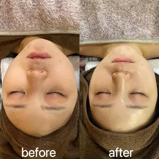 eminy所属・Yuuki 陶肌トリートメントのエステ・リラクイメージ