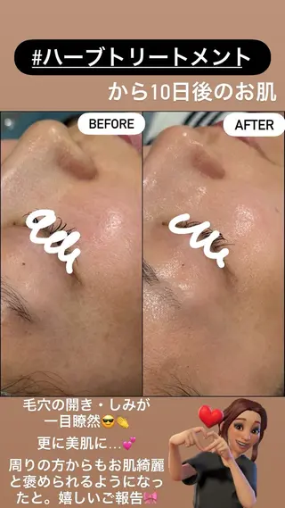 LiZA エステティックサロンのエステ・リラクイメージ