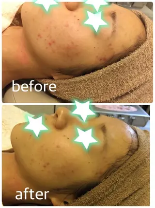 BLOOM〜 天恵（てんのめぐみ）のエステ・リラクイメージ