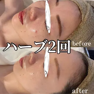 中目黒ハーブピーリン グ🌿ララピールのエステ・リラクイメージ