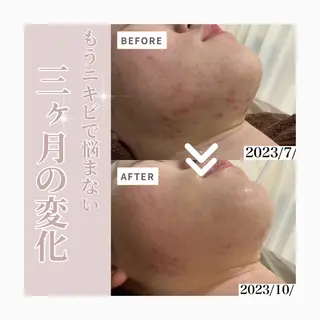 Horishia 福岡博多店のエステ・リラクイメージ