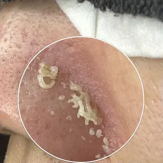 毛穴&リンパマッサージ専門サロン　花のWA所属・毛穴&リンパマッサー ジ専門サロン花のWAのエステ・リラクイメージ