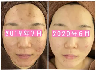 ミディアム カラー パーマ ヘアアレンジ メンズ キッズ ネイル マツエク・マツパ ニキビ・肌質改善専門 ♡人生が変わるサロンのエステ・リラクイメージ