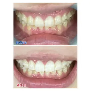 M渋谷店所属・Ｍ渋谷 ホワイトニングのその他イメージ