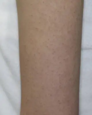 KiraBelle 佐々木 智美のその他イメージ