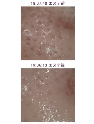 丸の内ヒルズ 鈴木麻瑚のエステ・リラクイメージ