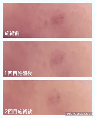 ルラーシュ　チーフ 川田美穂のエステ・リラクイメージ