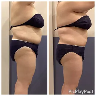 RICHE 【リッシュ】のエステ・リラクイメージ