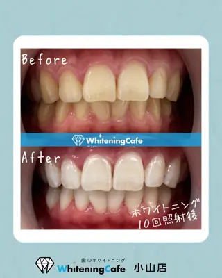 ホワイトニングカフェ 小山店のエステ・リラクイメージ