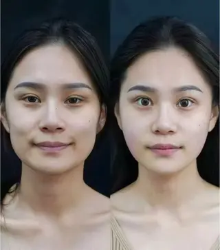 マツエク・マツパ aliaハイフ&水光ジェットサロン所属・aliaハーブ水光店 エステティシャン募集のエステ・リラクイメージ