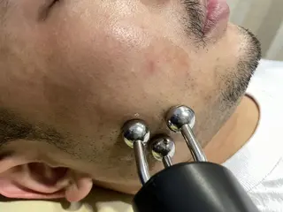 メンズ むくみたるみ専門☆ 美容鍼・小顔矯正のエステ・リラクイメージ