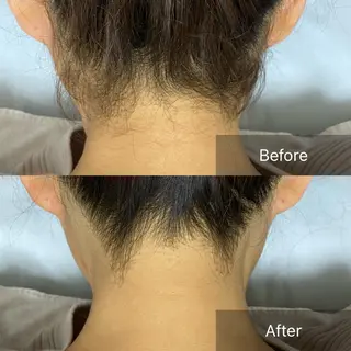 港区都度払い脱毛 miranjuのエステ・リラクイメージ