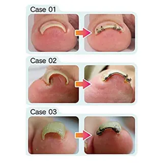 メンズ キッズ ネイル 🌱 ま し お 🌱のその他イメージ
