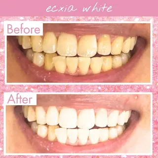 セルフホワイトニング エクシア大府店のその他イメージ