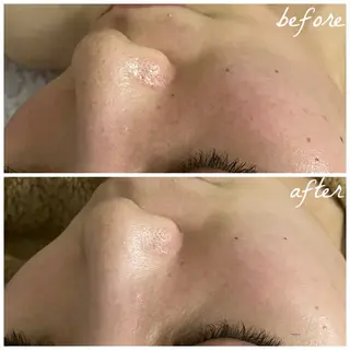 メンズ メナード岐阜茜部 杉浦のエステ・リラクイメージ