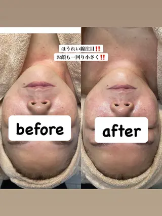 salon La•Junavie所属・上野[毛穴][小顔] Yukikoのエステ・リラクイメージ