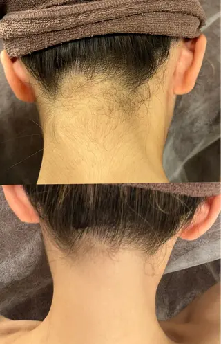 脱毛専門サロンElixir所属・脱毛専門サロン ELIXIR館林店のエステ・リラクイメージ